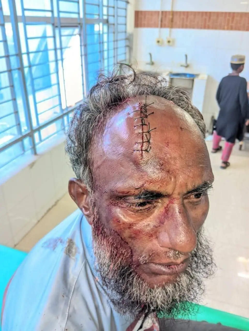 ভোলায় বিজেপির কর্মসূচিতে বিএনপির হামলা!