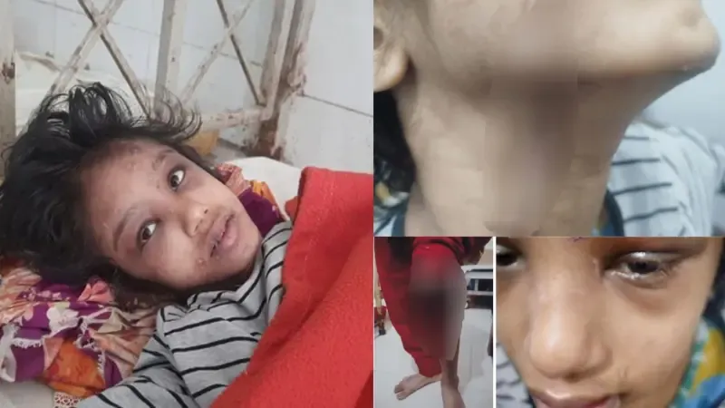 বিশ্ব আতঙ্কে এপস্টেইন কেলেঙ্কারি, দেশ শোকাহত মোহনার যন্ত্রণায়